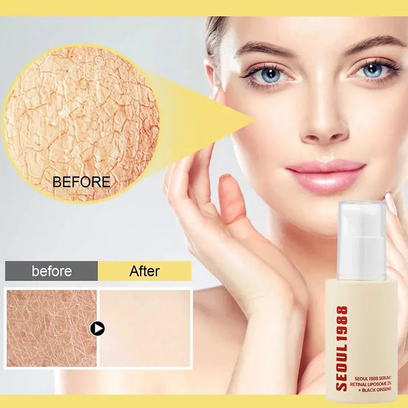 Korean Brand Skin Care Set Seoul 1988 Anti-aging Brightening Eye Cream Sunscreen Anti-wrinkle Essence Rice Cream Essence Water