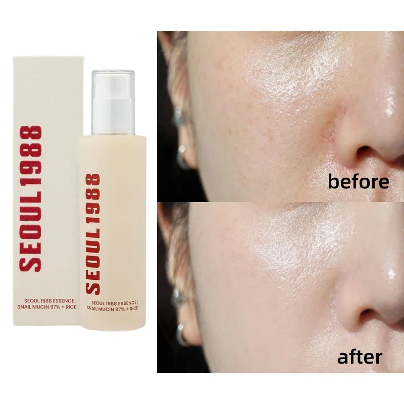 Korean Brand Skin Care Set Seoul 1988 Anti-aging Brightening Eye Cream Sunscreen Anti-wrinkle Essence Rice Cream Essence Water